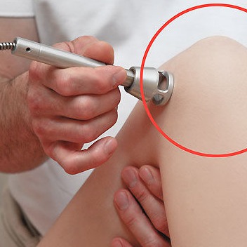Lasertherapie Anwendungen